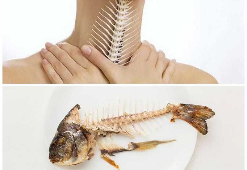 Sự Thật Về Mẹo Chữa Hóc Xương Cá Bằng Đũa